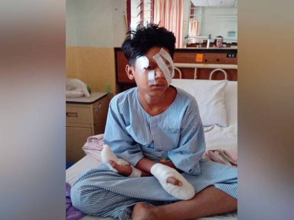 Remaja lelaki hancur tiga jari angkara mercun, “Saya menyesal!”