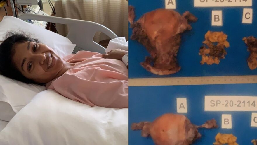 Terpaksa buang rahim, Nourul Depp pesan buat ‘Check Up’ setiap tahun, jaga kesihatan!