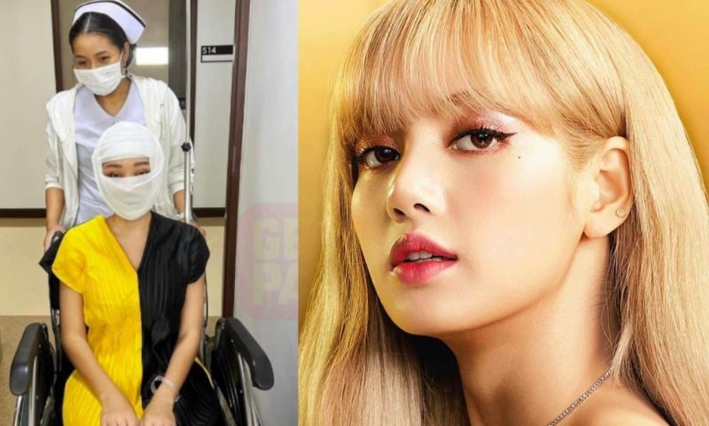 Lucinta Luna lakukan pembedahan muka ingin kelihatan seperti Lisa Blackpink, “Good bye LUCINTALUNA”