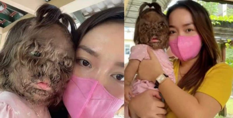 Wanita teruja jumpa bayi viral hidap sakit ‘Rare’, wargamaya titip doa semoga sentiasa sihat dan dipermudakan urusan