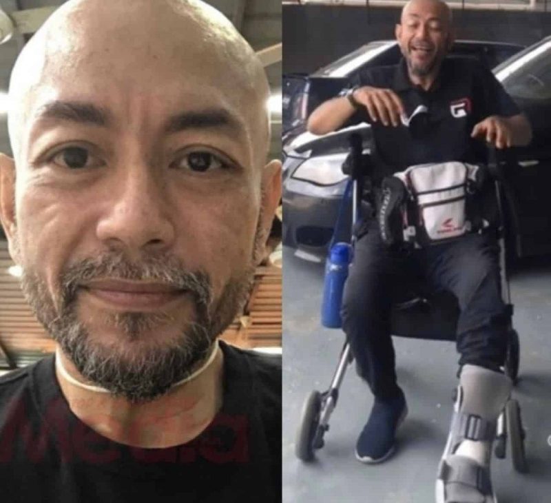 Semua jari kaki kiri Bad Indigo sudah dipotong