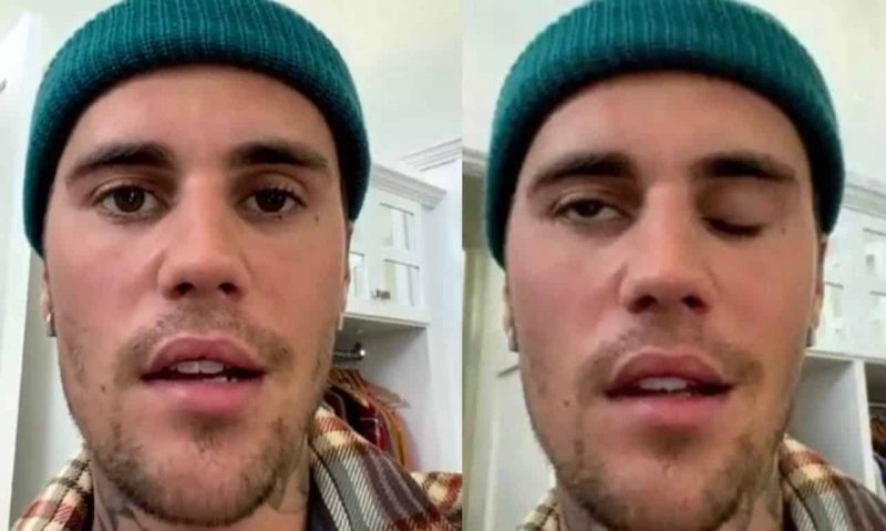 Justin Bieber diserang sindrom ‘Ramsay Hunt’, terpaksa batalkan beberapa konsert